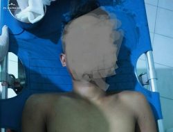 Tabrakan Sepeda Motor, Satu Pengendara Meninggal Di Praya